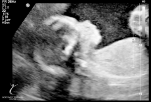 ultrasound 2014-12-10 07.jpg